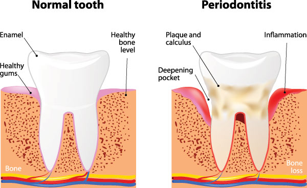 Crown Point Smiles | Emergency Treatment, All-on-4 reg  and Implant Restorations