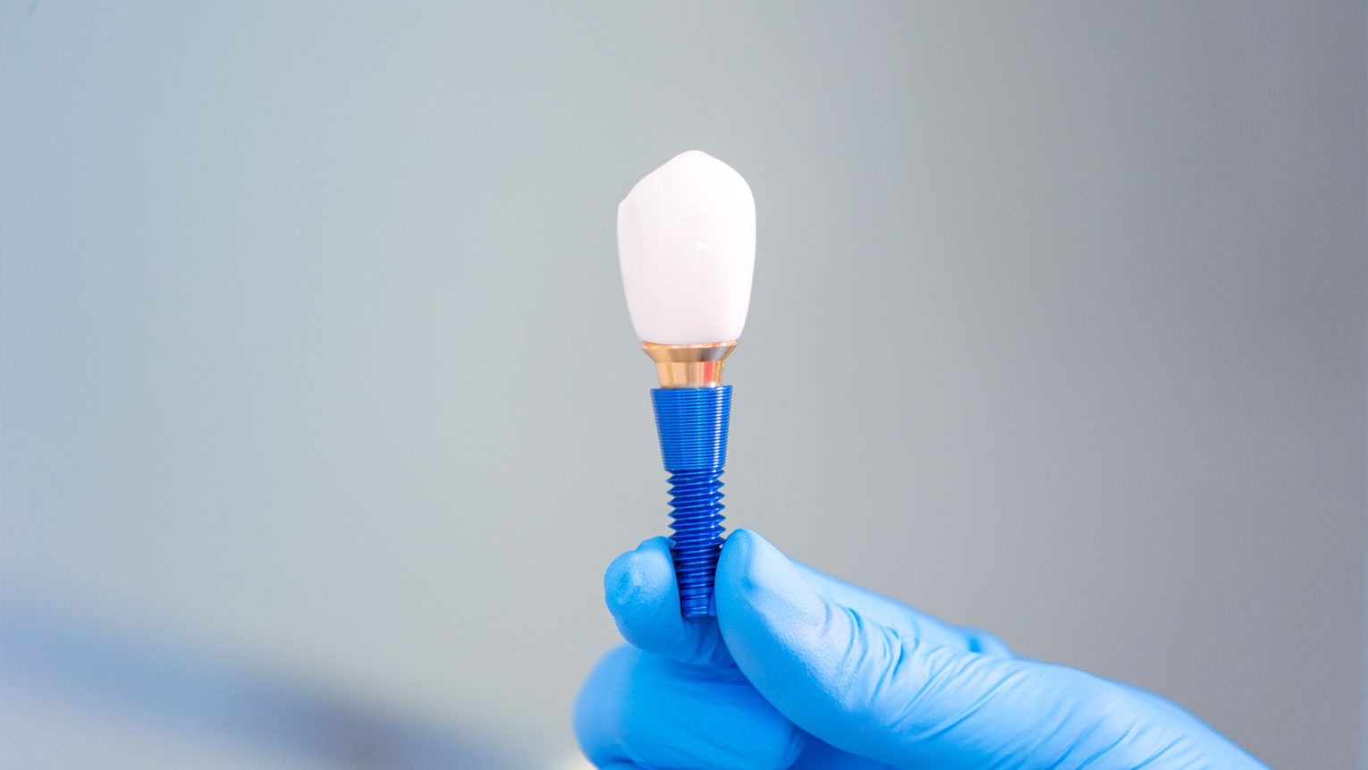 How to Care for Dental Implants