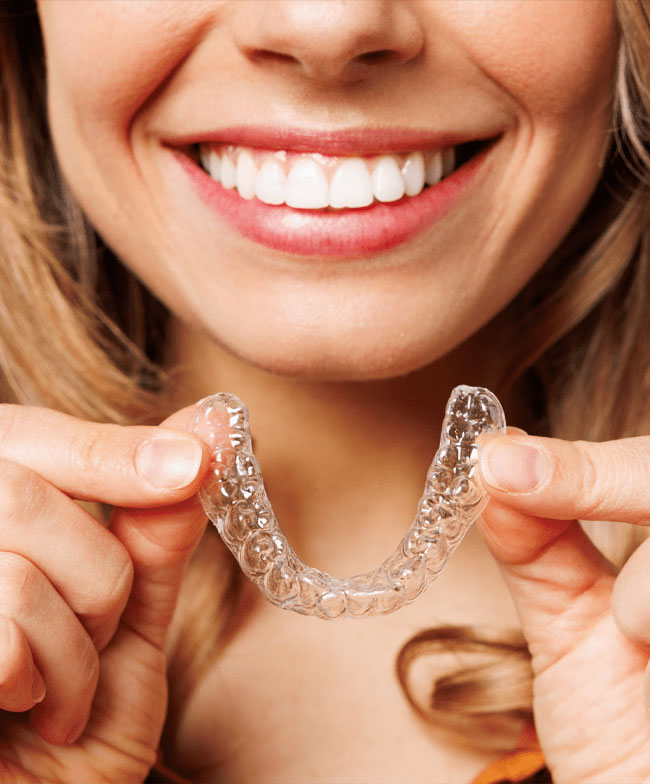 Invisalign clear aligners for straightening teeth